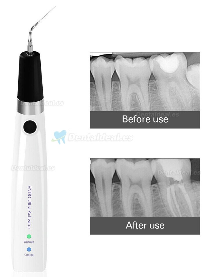 Sonic Endoactivador 300°Irrigación en Endodoncia Pieza de Mano para Endodoncia Activador Endodoncia +6pcs Titanio Puntas